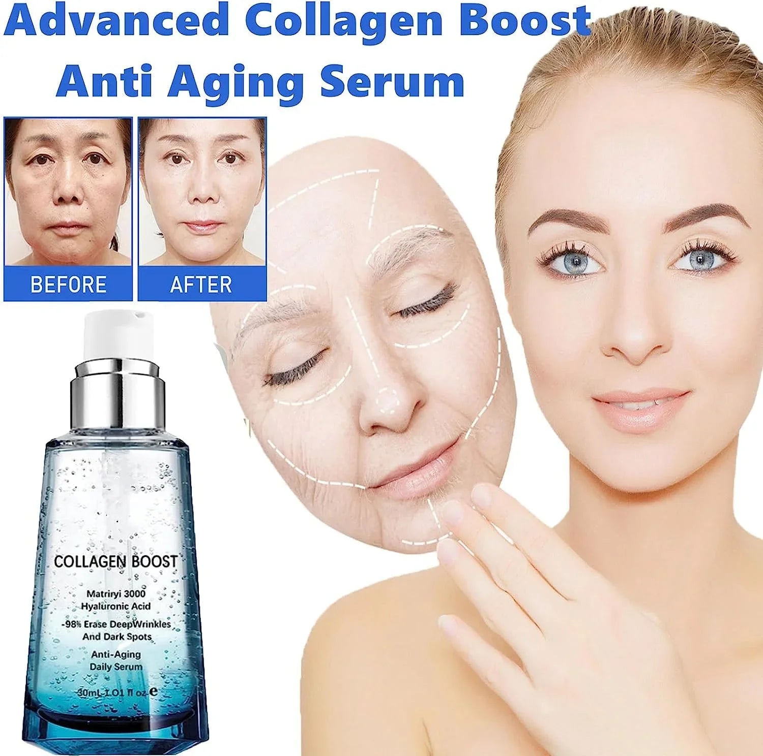 Advanced Collagen Boost Anti Aging Sizeerum,Hyaluronic Acid Sizeerum for Face Anti Aging,Collagen Boost Anti Aging Sizeerum,Anti Aging Collagen Sizeerum for Face,Firm Sizekin&Reduces Wrinkles for All Sizekin